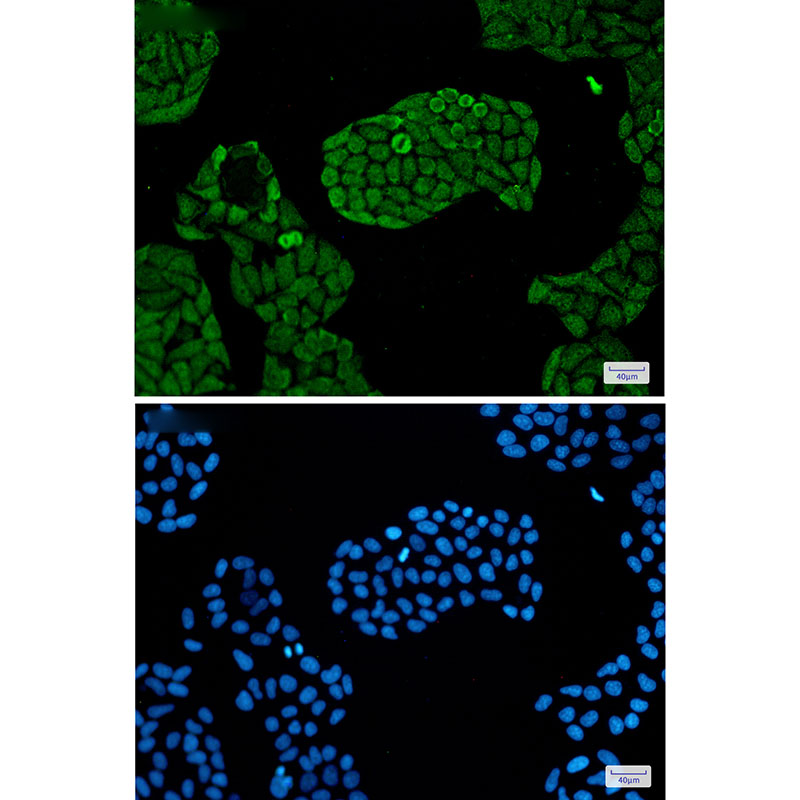 PSMC5 Rabbit mAb